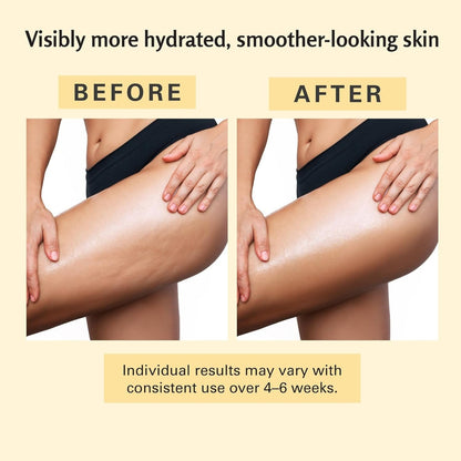 Anti-Cellulite Massage Oil, Collagen + Stem Cell Infused